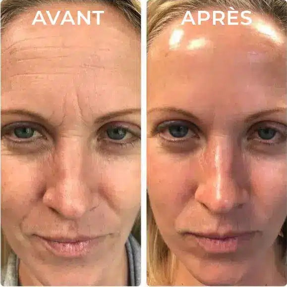 Revitalift soin anti rides instantané