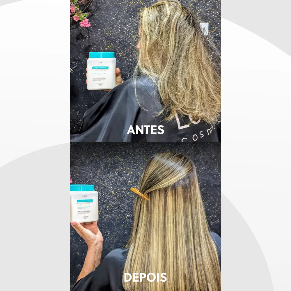 Botox Organique
