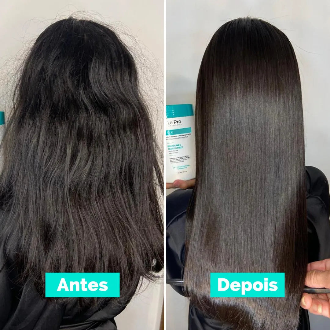 Botox Organique